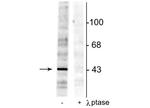 Phospho-EphB2 (Tyr298) Antibody in Western Blot (WB)