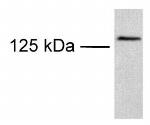 TRPM8 Antibody in Western Blot (WB)