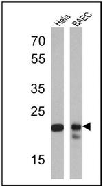 PSMB6 Antibody in Western Blot (WB)