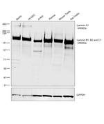 Laminin A/B Antibody in Western Blot (WB)