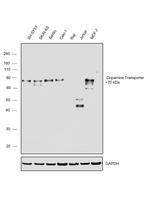 Dopamine Transporter Antibody in Western Blot (WB)