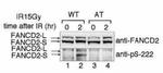 Phospho-FANCD2 (Ser222) Antibody in Western Blot (WB)