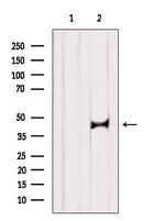 ST8SIA2 Antibody in Western Blot (WB)