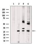 CNOT8 Antibody in Western Blot (WB)