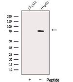 DDX43 Antibody in Western Blot (WB)