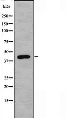 CDK10 Antibody in Western Blot (WB)