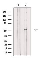PPHLN1 Antibody in Western Blot (WB)