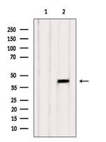 CDCA7 Antibody in Western Blot (WB)