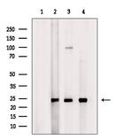 MRPS7 Antibody in Western Blot (WB)