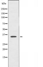 NEURL2 Antibody in Western Blot (WB)