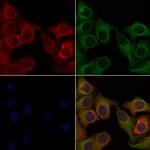 SLC52A1 Antibody in Immunocytochemistry (ICC/IF)
