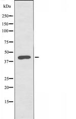 SLC52A1 Antibody in Western Blot (WB)