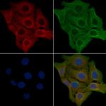 RXFP2 Antibody in Immunocytochemistry (ICC/IF)