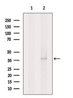 ADORA2B Antibody in Western Blot (WB)