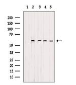 C19orf61 Antibody in Western Blot (WB)