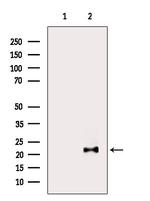MED22 Antibody in Western Blot (WB)