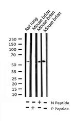 Phospho-Chk2 (Thr68) Antibody in Western Blot (WB)