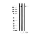 Phospho-Filamin A (Ser2152) Antibody in Western Blot (WB)