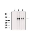 Phospho-AKT1 (Ser124) Antibody in Western Blot (WB)