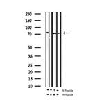 Phospho-ZAP-70 (Tyr493) Antibody in Western Blot (WB)