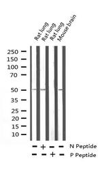 Phospho-CaMKII alpha/delta (Thr286) Antibody in Western Blot (WB)