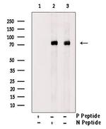 Phospho-DR6 (Thr460) Antibody in Western Blot (WB)