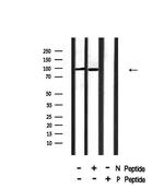 Phospho-INSR (Tyr999) Antibody in Western Blot (WB)