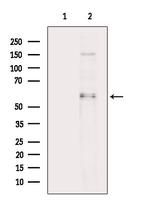Phospho-CEACAM1 (Ser508) Antibody in Western Blot (WB)