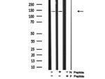 Phospho-PDGFRA (Tyr762) Antibody in Western Blot (WB)