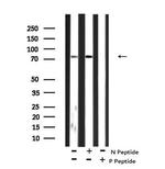 Phospho-MSK2 (Ser196) Antibody in Western Blot (WB)