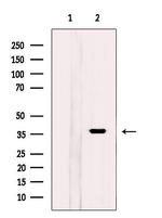 KCTD12 Antibody in Western Blot (WB)