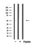 CEP57 Antibody in Western Blot (WB)