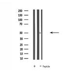 SLC30A4 Antibody in Western Blot (WB)