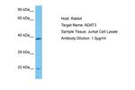 ADAT3 Antibody in Western Blot (WB)