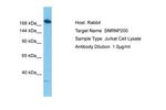 SNRNP200 Antibody in Western Blot (WB)