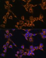 RAMP1 Antibody in Immunocytochemistry (ICC/IF)