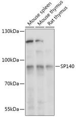 SP140 Antibody in Western Blot (WB)