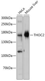 THOC2 Antibody in Western Blot (WB)