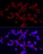 TRPC5 Antibody in Immunocytochemistry (ICC/IF)