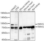 TRPV5 Antibody in Western Blot (WB)
