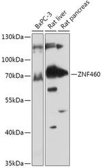 ZNF460 Antibody in Western Blot (WB)
