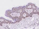 PCYT1A Antibody in Immunohistochemistry (Paraffin) (IHC (P))