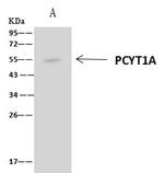PCYT1A Antibody in Immunoprecipitation (IP)
