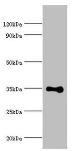 RAD51D Antibody in Western Blot (WB)