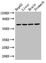 RCBTB2 Antibody in Western Blot (WB)
