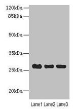 C10orf82 Antibody in Western Blot (WB)