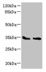 SLC25A36 Antibody in Western Blot (WB)