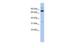 FAM161B Antibody in Western Blot (WB)