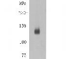 Desmoglein 3 Antibody in Western Blot (WB)