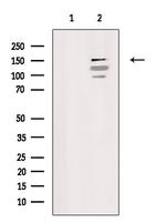 SMG6 Antibody in Western Blot (WB)
